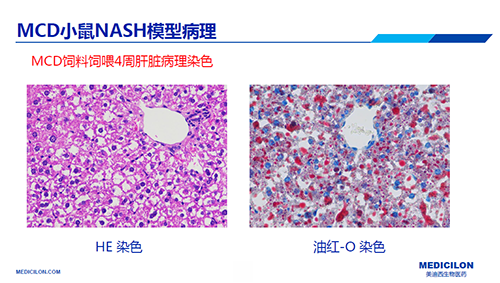 幼鼠NASH模型