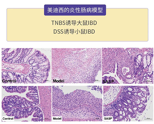6008集团的炎症性肠病模型