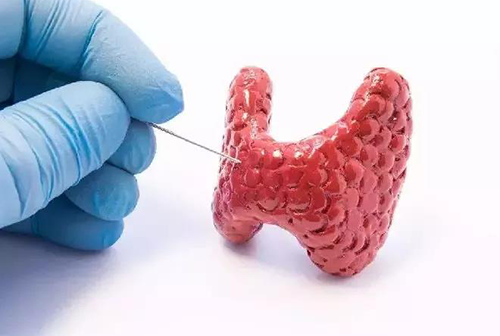 甲状腺疾病，蕴含甲状腺职能减退和甲状腺职能亢进，自古以来就是反复被医学钻研人员钻研的疾病