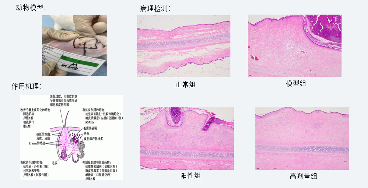 案例3:新西兰兔痤疮药效钻研.jpg 案例3:新西兰兔痤疮药效钻研.jpg